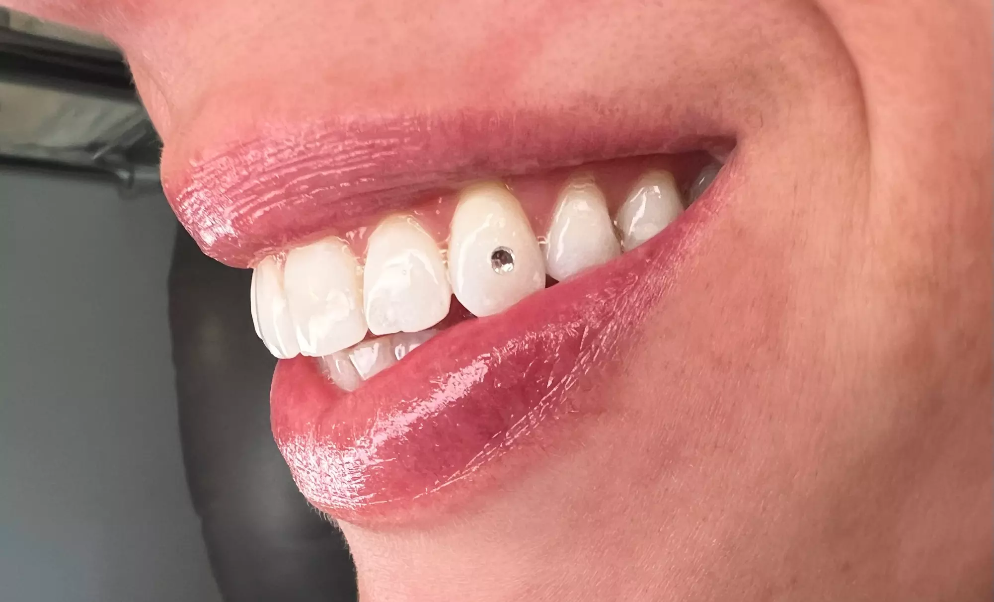 Sparkle up with One or Two Tooth Gems for a Bright Smile