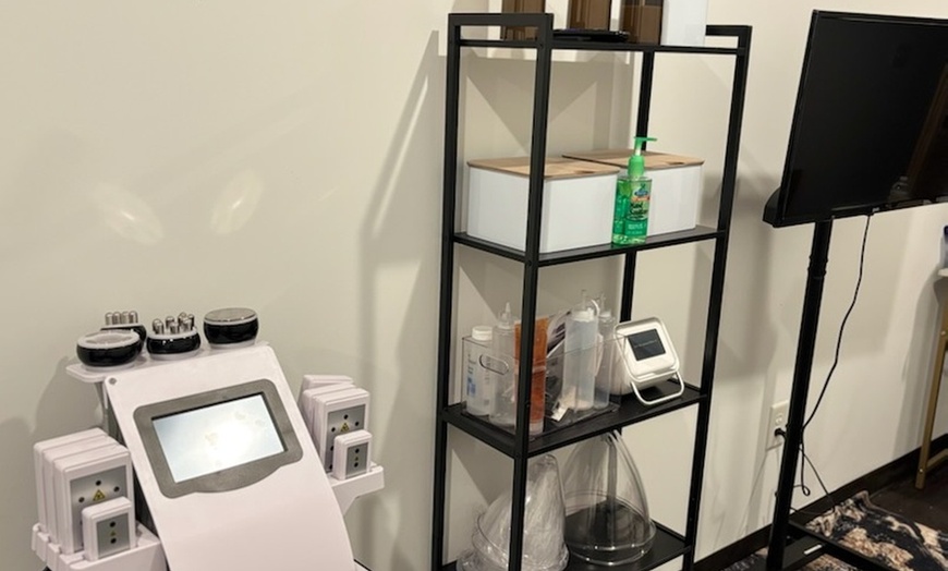 Image 3: RF Skin Tightening – Firm & Smooth Skin with No Downtime