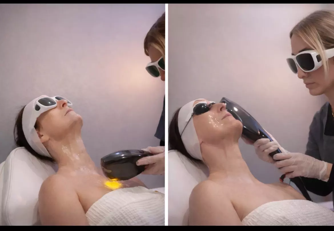 Rejuvenate Your Skin with One or Three Photofacial IPL Treatment at ClearSkin Laser Co (Up to 44%Off) - Primary Image