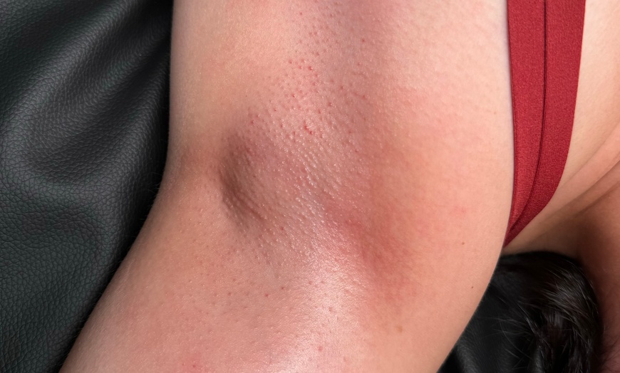 Image 3: Up to 33% Off on Brazilian / Bikini Waxing at Cherish your Skin