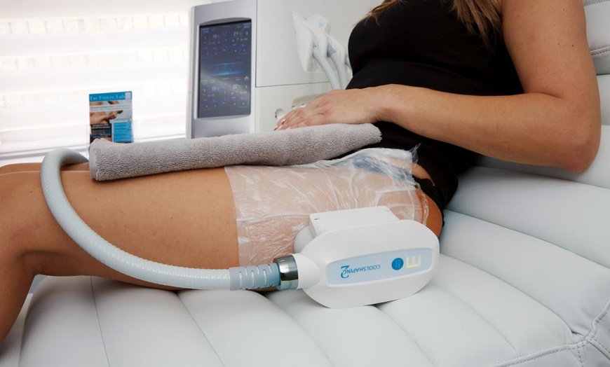 Image 3: Up to 64% Off on Cryotherapy at Fat freeze lab