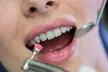 In-Office Crown Whitening Treatment with Consultation and Optional Whitening Kit at Green Dental (Up to 52% Off) - Image 5