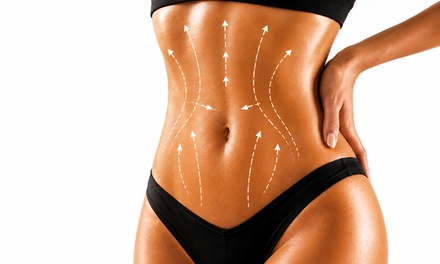 One 30-Minute EMS Body Sculpt Session - House Of Dolls Aesthetics and Body Sculpting