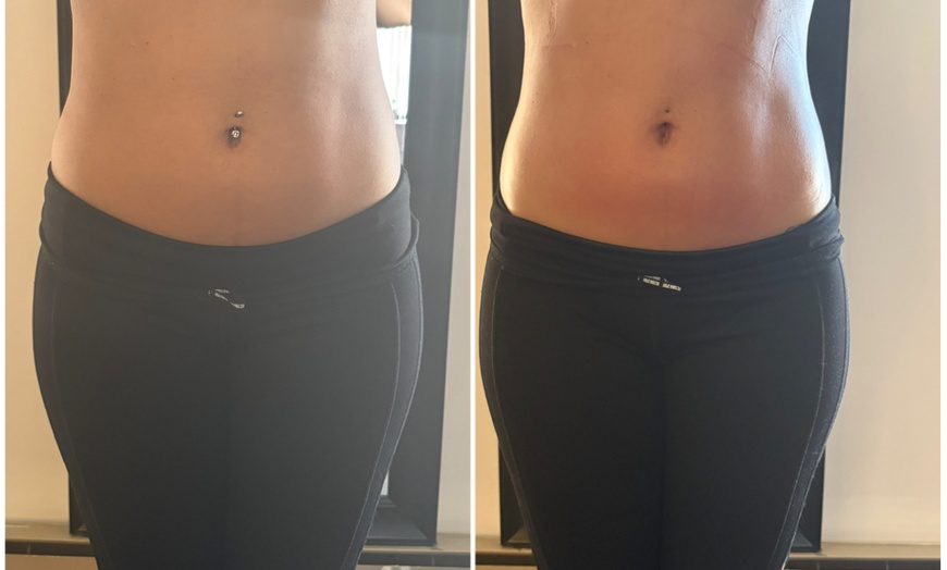 Image 4: Up to 61% Off on Ultrasonic Fat Reduction at Travel Goddess Bodies