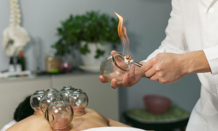 Image 4: Revitalize with 1 or 3 Acuwave Detox Cupping Sessions for 30 Mins
