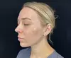 One or Three Laser Skin Brightening Treatment at River Oaks Galleria Medspa - Up to 51% Off