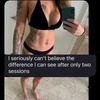 Image 2: Single Session of BodyFX or MiniFX Fat Reduction and Skin Tightening