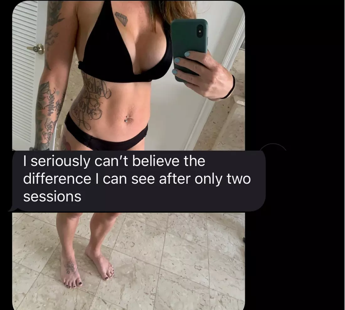 Single Session of BodyFX or MiniFX Fat Reduction and Skin Tightening
