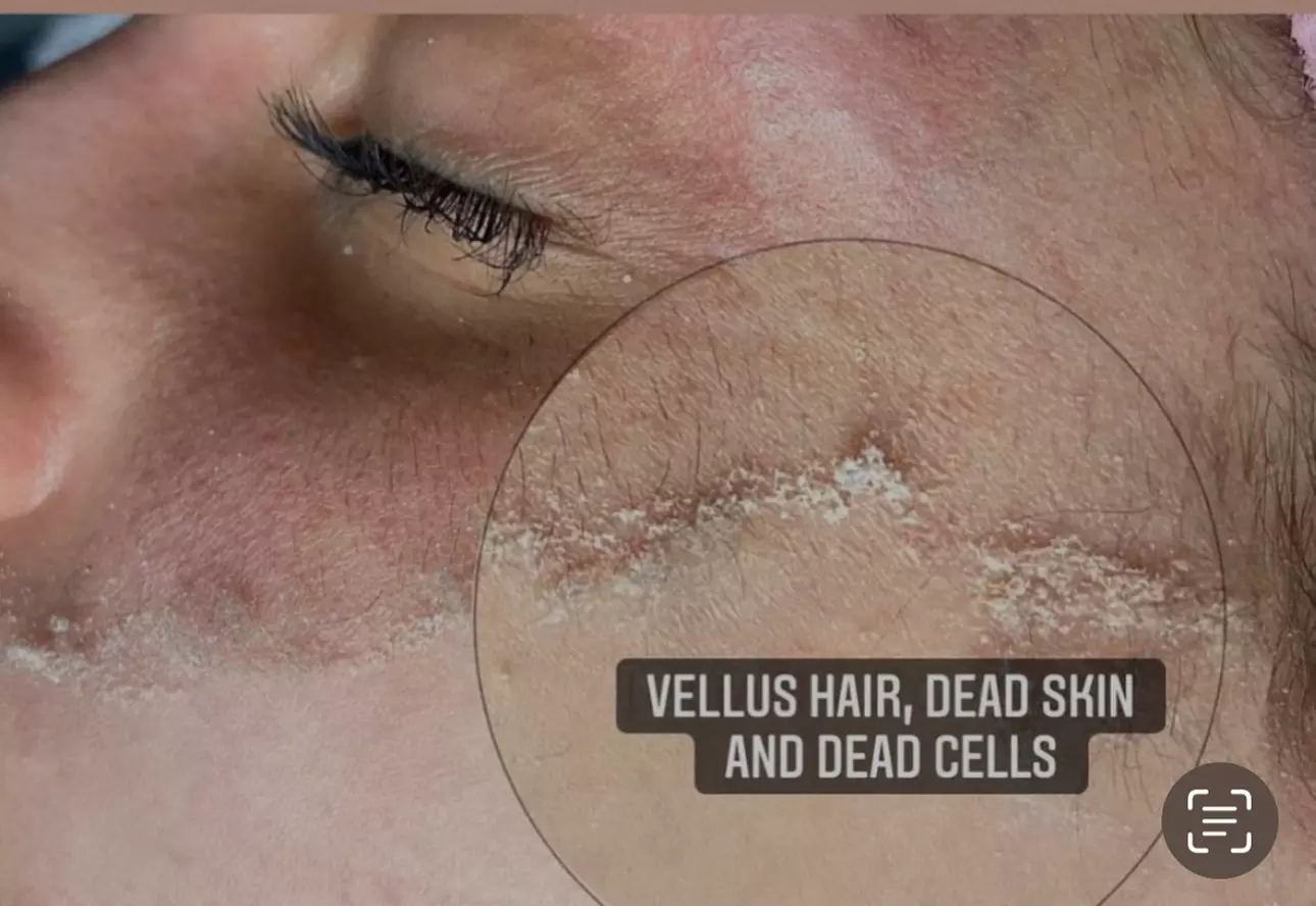 Up to 35% Off on Facial at Ursula Versace Aesthetics