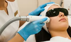 Elevate Beauty w/ The Caci Clinic's Bios Laser Pigmentation - One, Two, or Three 5cm² Area (Up to 81% Off)