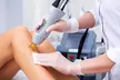 Six Laser Hair Removal Sessions on a Choice of Area at Laser Perfection - Image 2