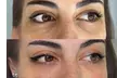 Revitalize Your Skin with One or Two PRP Facial Sessions with Microneedling or One PRP Injection (Up to 36% Off) - Second Medium