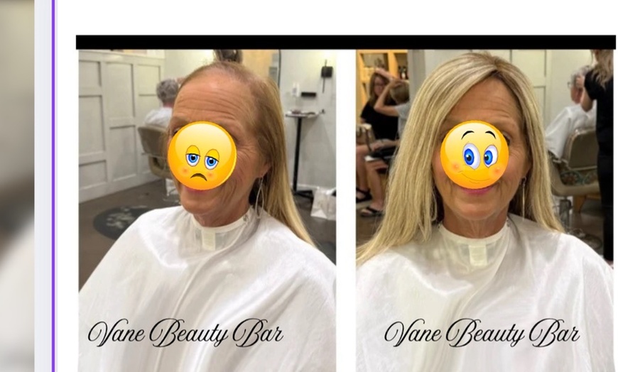 Image 1: Up to 56% Off on Laser Hair Restoration at Vane Beauty Bar