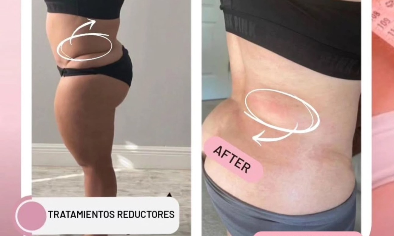 Up to 40% Off on Lymphatic Drainage Massage at NC Beauty studio