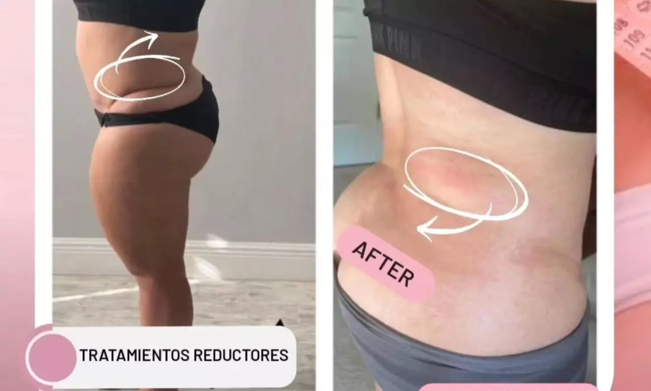 Up to 40% Off on Lymphatic Drainage Massage at NC Beauty studio - Primary Image