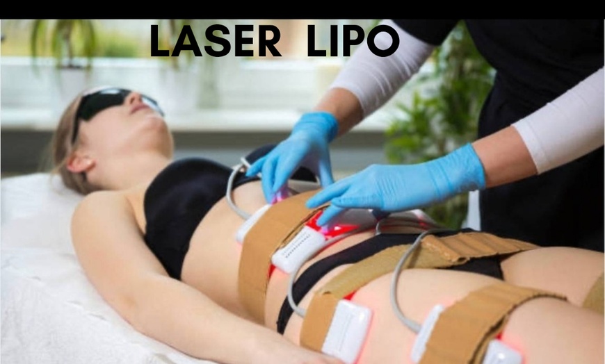 Image 2: Six or Three Non Surgical Laser Lipo Cavitation Treatments