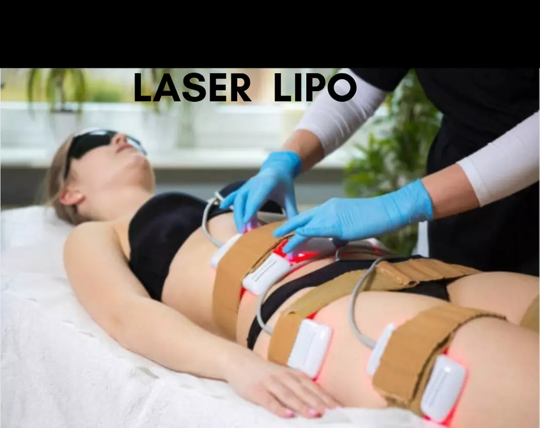Six or Three Non Surgical Laser Lipo Cavitation Treatments
