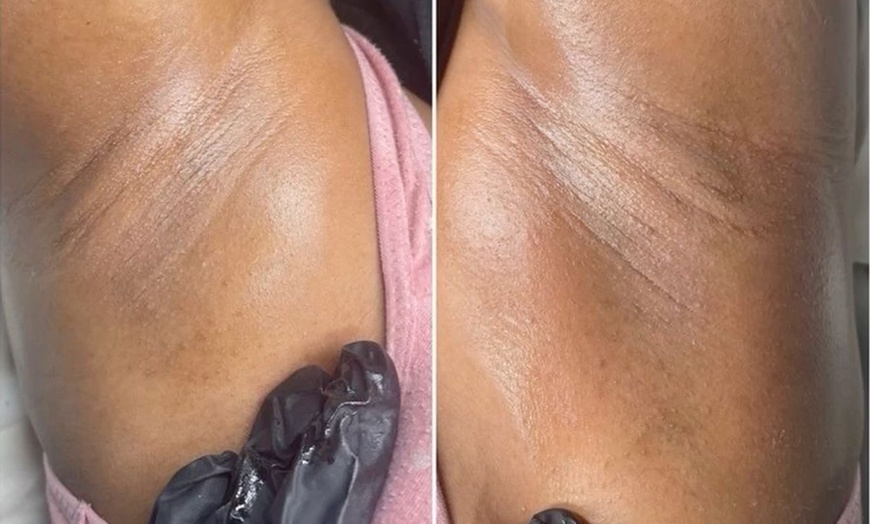 Image 2: Get Tailored Brazilian Wax Sessions for Smooth, Confident Skin