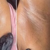 Image 2: Get Tailored Brazilian Wax Sessions for Smooth, Confident Skin