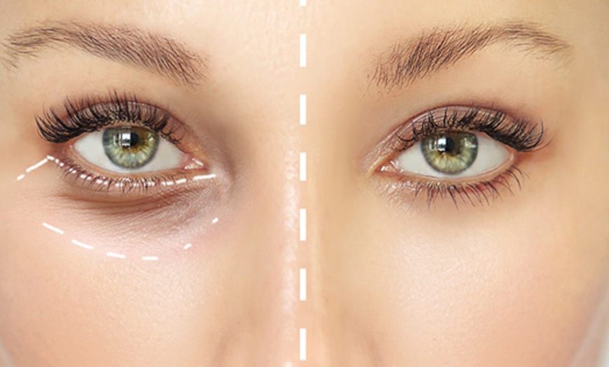 Image 1: Soin Mesolift contour des yeux chez Institut Danielle Lanstère