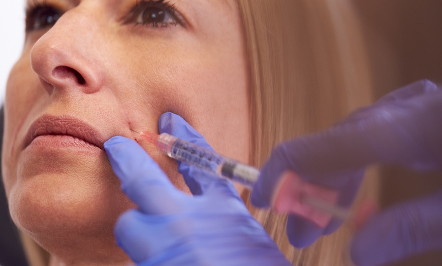 Image 1: Up to 53% Off on Injection - Dermal Filler at UK Aesthetics Lounge