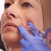 Image 1: Up to 53% Off on Injection - Dermal Filler at UK Aesthetics Lounge