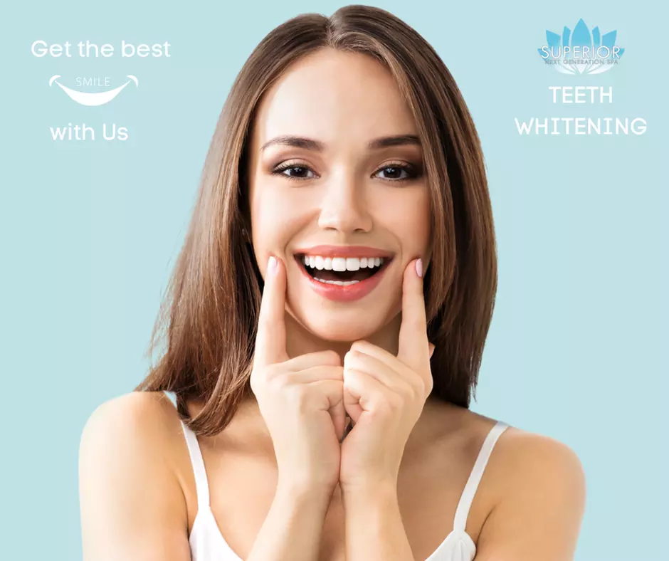 Experience Brite Smile teeth whitening at Superior Next Generation Spa with options up to 50% off for stunning results. - Primary Image