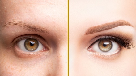One Microblading Session for both Eyebrows. - Rewind Aesthetics Dermatology and Trichology