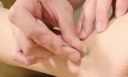 90-Minute Initial Acupuncture Session with Comprehensive Consultation - LYS Acupuncture
