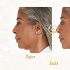Image 3: Up to 65% Off on Ultrasound at IVE MEDICAL SPA