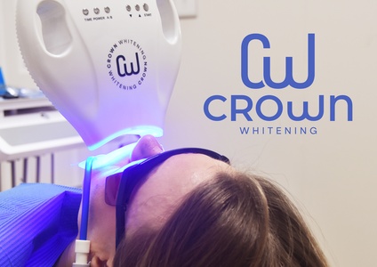 One-hour Crown Whitening in-office laser teeth whitening treatment with consultation - Green Dental