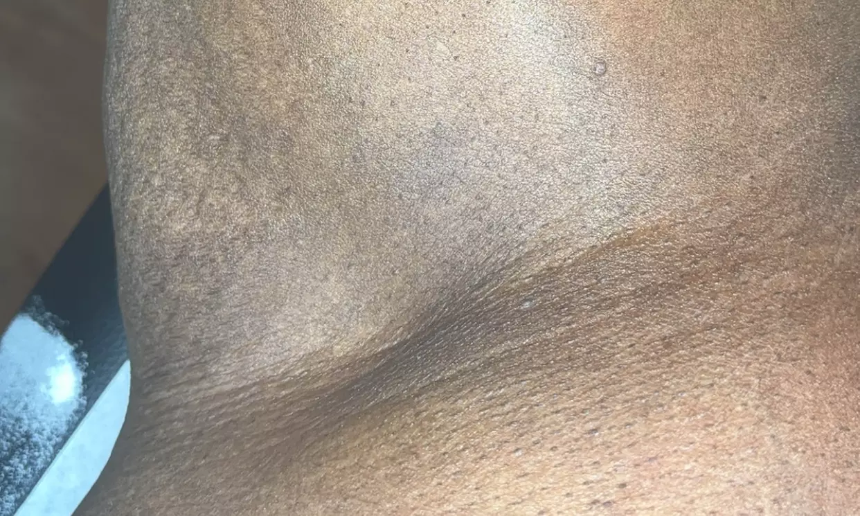 Get Smooth with 1, 3, 5, or 10 Brazilian/Bikini Wax Sessions