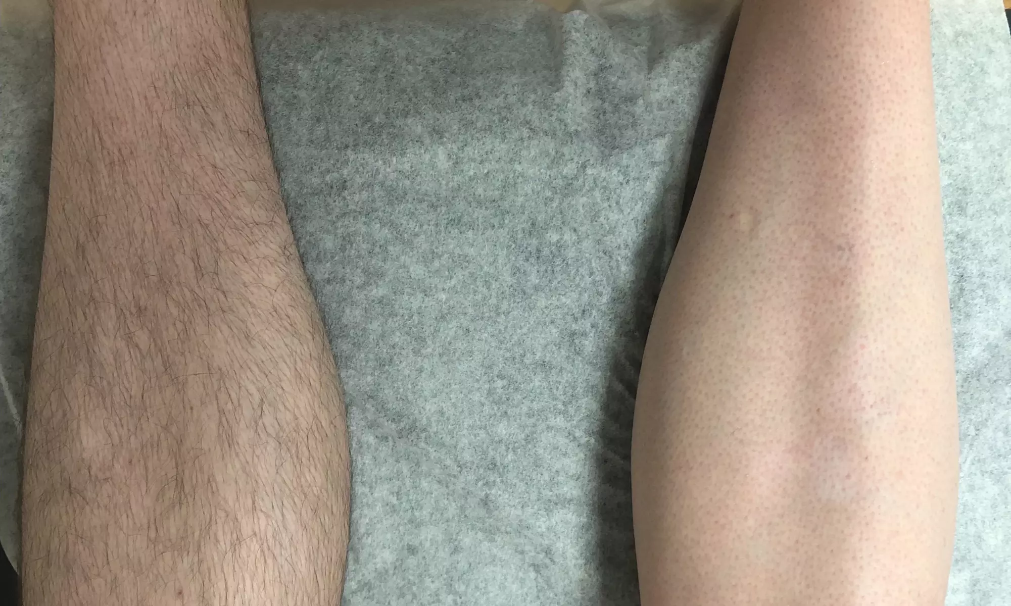 Smooth and Soft Skin with Bikini Line or Brazilian Waxing