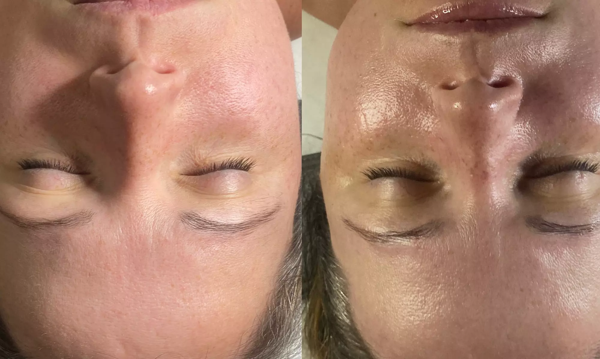 Up to 46% Off on Exfoliating Facial at Exclusives Skin Bar LLC