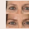 Image 2: Defined Brows & Lips with Microblading or Lip Blush