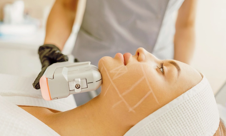 Image 12: Lifting Coréen avec radiofréquence ou carbon laser glow ou soin HIFU