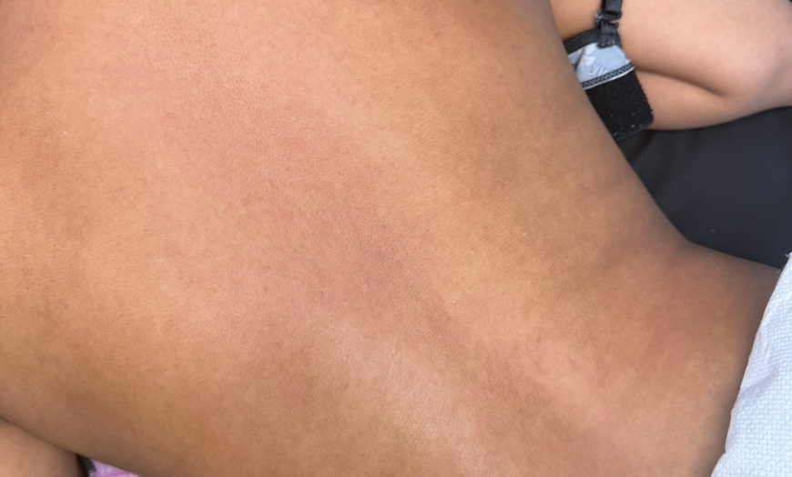 Image 3: Women’s Brazilian, Back & Full Leg Waxing for Smooth Skin