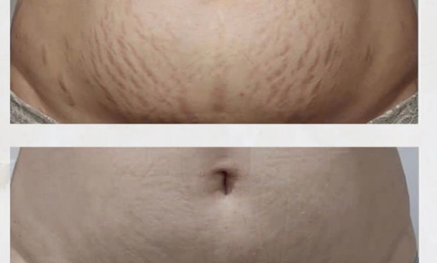 Image 3: Up to 50% Off on Tattooing at Pompano Esthetics