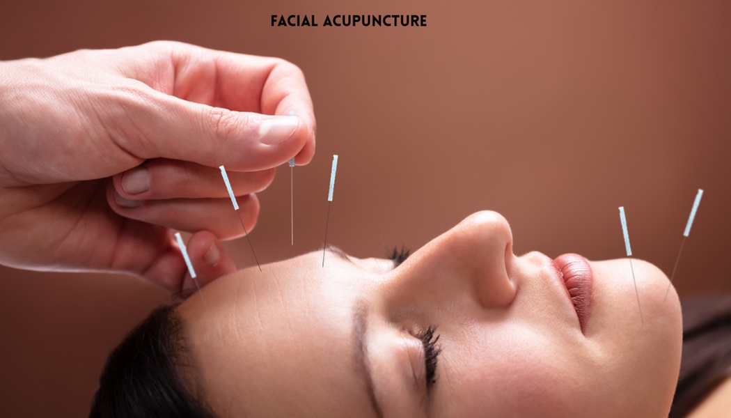 Enhance Your Beauty with Korean Facial Acupuncture