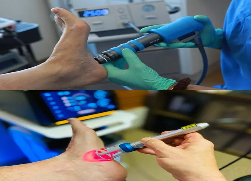 Shockwave (or Laser Combo) Therapy for Plantar Fasciitis + Foot Massage & Consultation - Primary Image