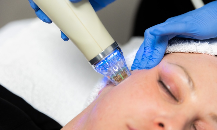 Image 2: Enhance Your Look w/ Radio Frequency Microneedling for Neck | Face or Abs | Knees at Loma Laser (Up to 73% Off)