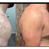 Image 3: Achieve Radiance with 6, 10, or 20 Dermalux MD Triwave LED Therapy 