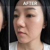 Image 1: Refresh w/ a Korean LHA PEEL for Face or with Neck