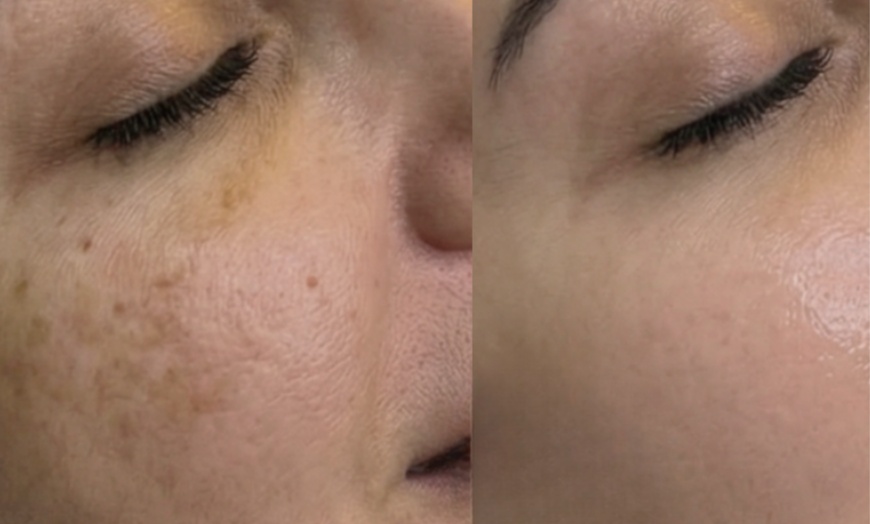 Image 4: Unifiez votre teint avec un soin anti-taches ciblé 5G Removal