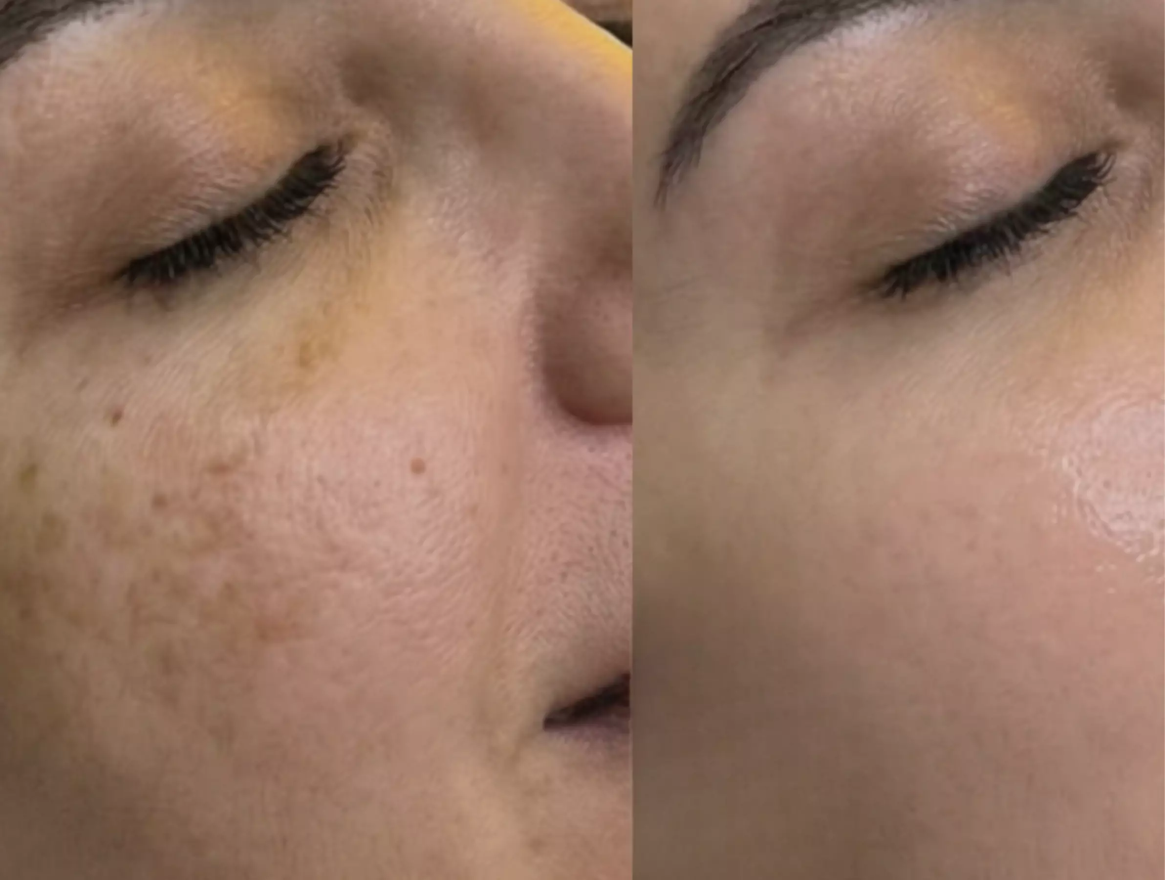 Unifiez votre teint avec un soin anti-taches ciblé 5G Removal