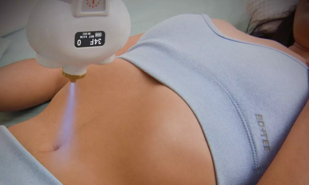 Cryoslimming for Stubborn Abdominal Fat: No Surgery, No Downtime at Lana Rosh Studio (Up to 45% Off)