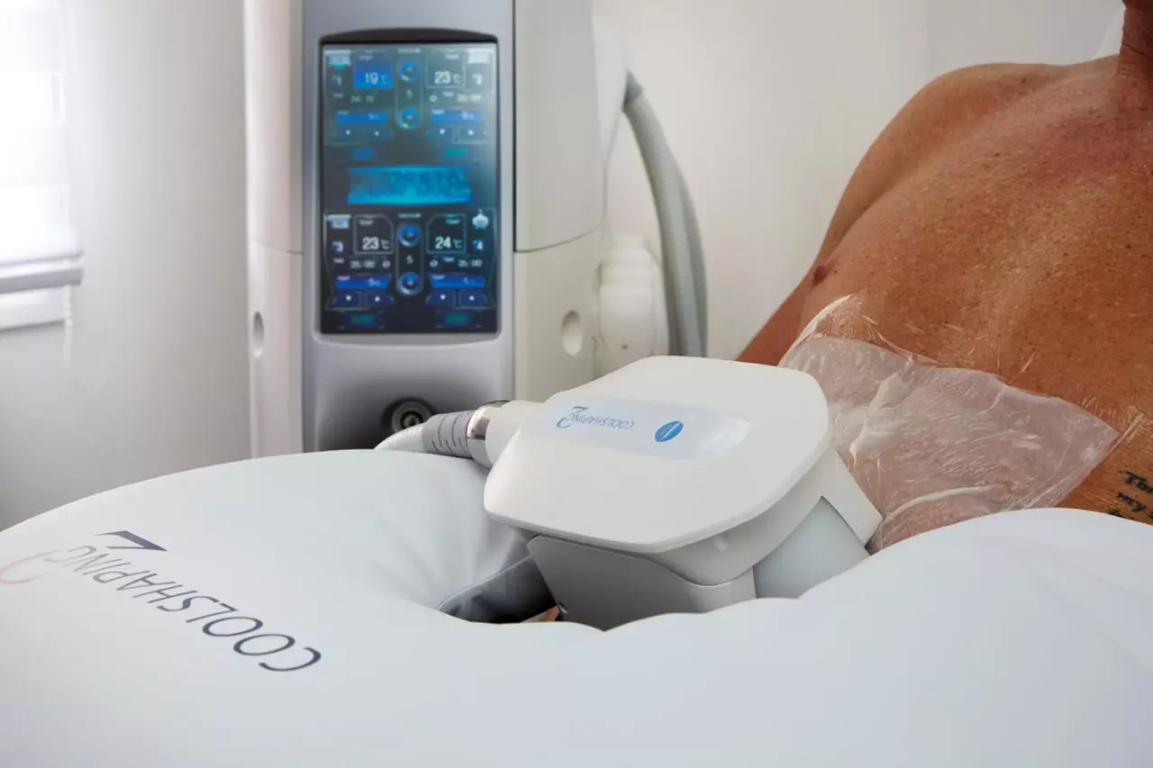 Up to 64% Off on Cryotherapy at Fat freeze lab