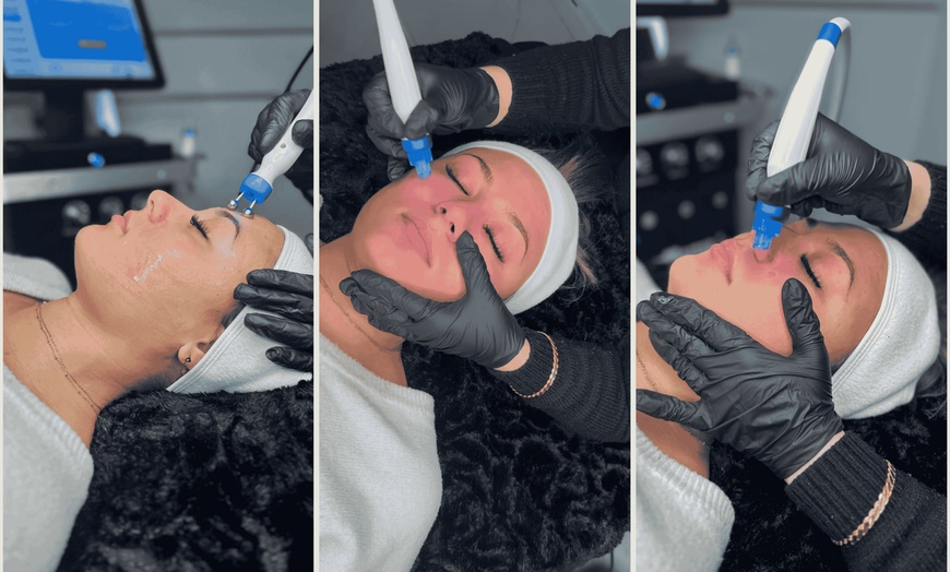 Image 2: Séance d'Hydrafacial et/ou de Dermapen chez Lux'Eclat