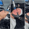 Image 2: Séance d'Hydrafacial et/ou de Dermapen chez Lux'Eclat