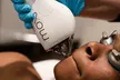 Comprehensive MOXI Laser Resurfacing – Face, Neck and Décolletage for up to 55% Off at Biorejuvenate - Second Medium